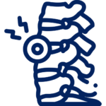 Sciatica